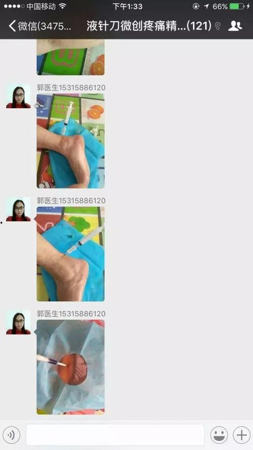小针刀视频,小针刀治疗技巧与实操解析